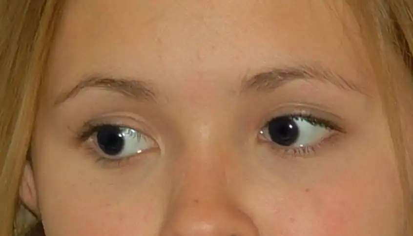 Photoshop Red Eye Tool Tutorial